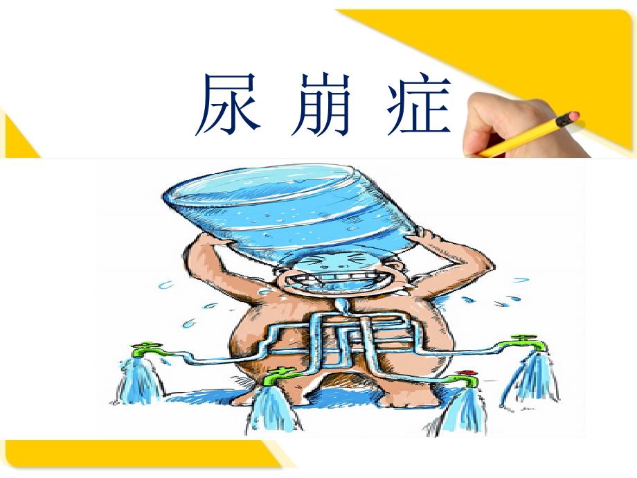 尿崩症PPT.ppt_第1页