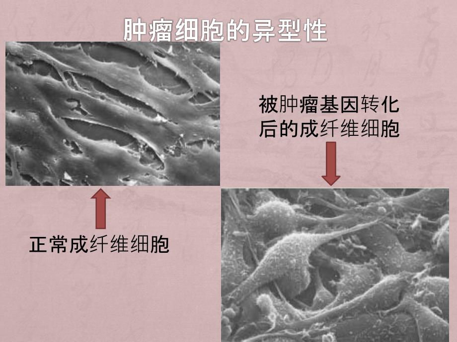 《医学细胞生物学》课件：第十六章 肿瘤细胞_第4页