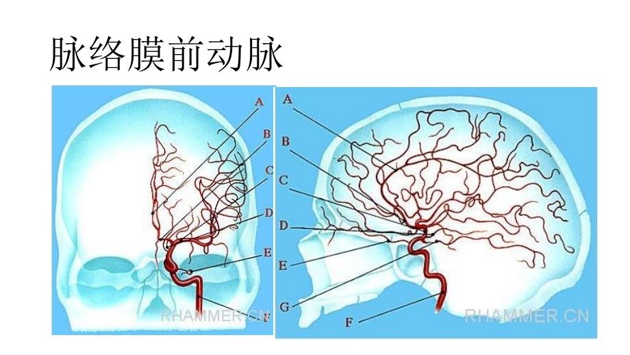 脑动脉解剖及临床脉络膜前动脉_第2页