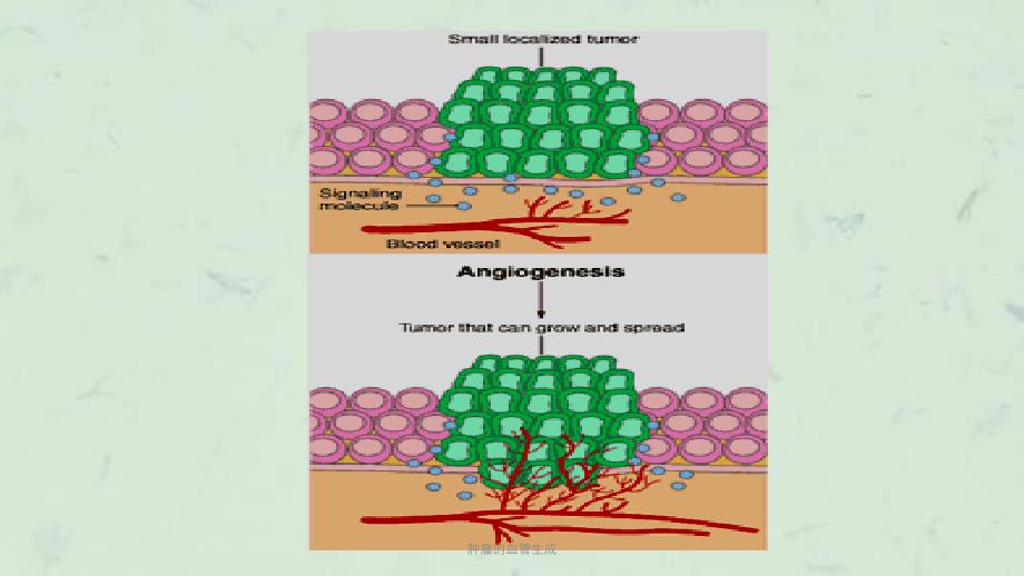 肿瘤的血管生成课件_第4页