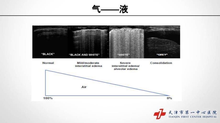 重症肺部超声PPT课件.ppt_第5页