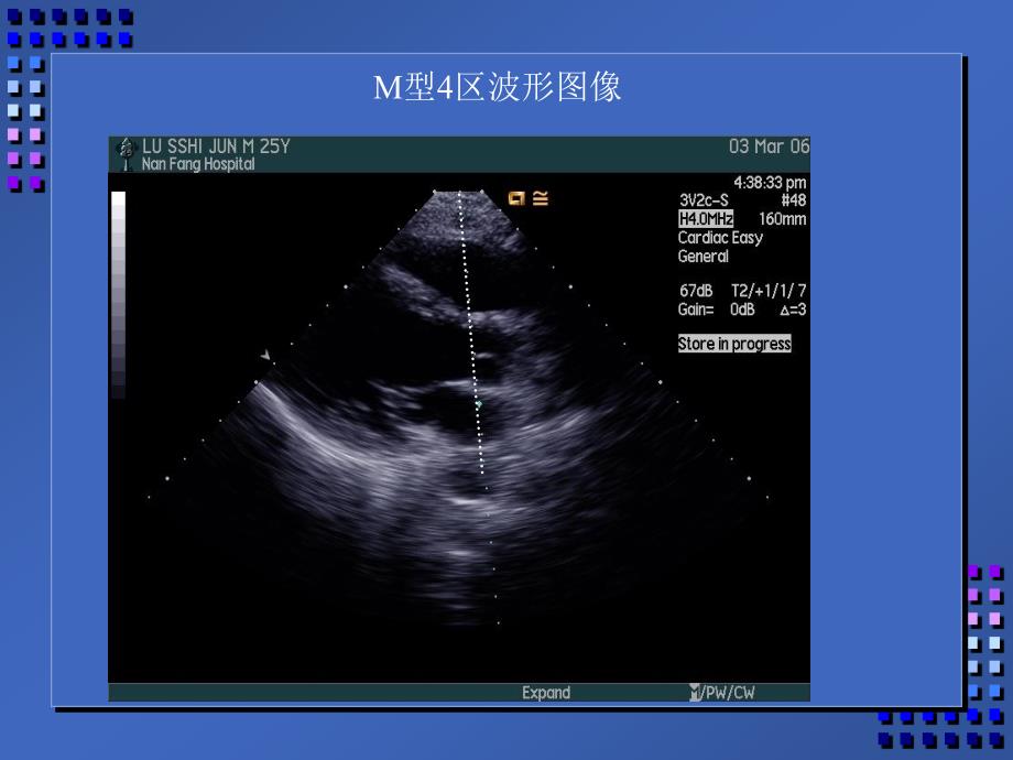 正常超声心动图(2)课件_第3页