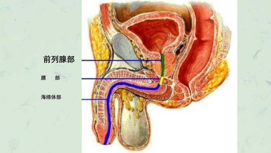 留置导尿的并发症及护理措施精课件_第4页