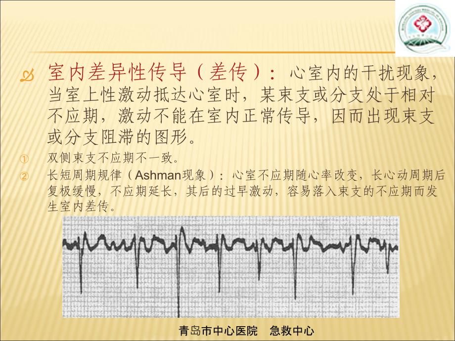 室性心动过速的心电图鉴别_第4页