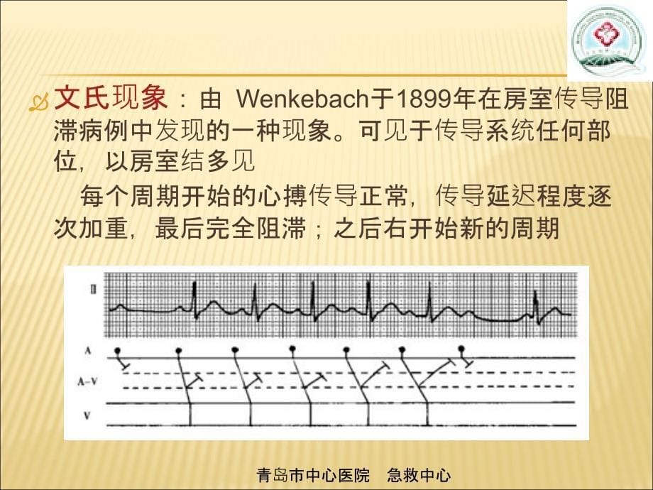 室性心动过速的心电图鉴别_第5页