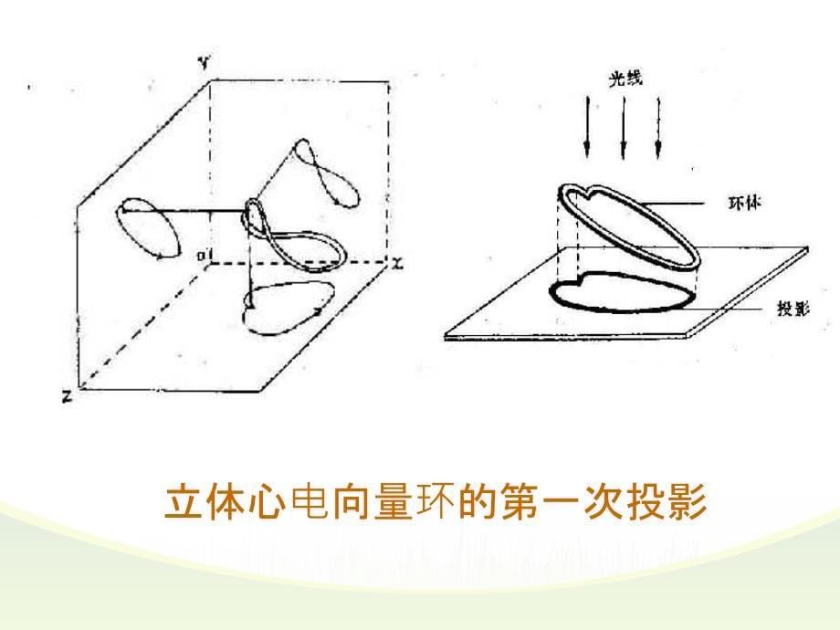 心电图心电向量详细讲解_第5页