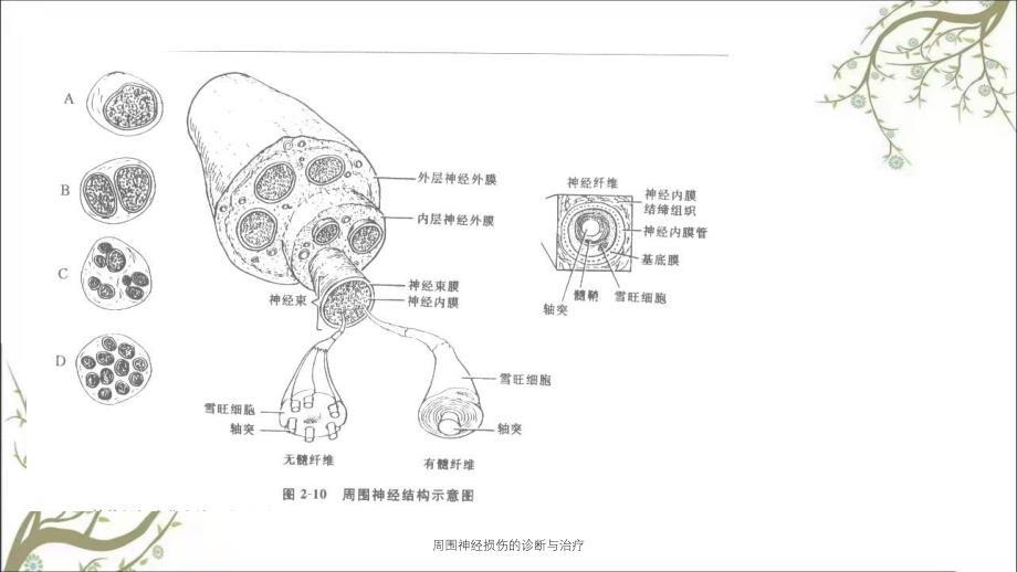 周围神经损伤的诊断与治疗_第4页