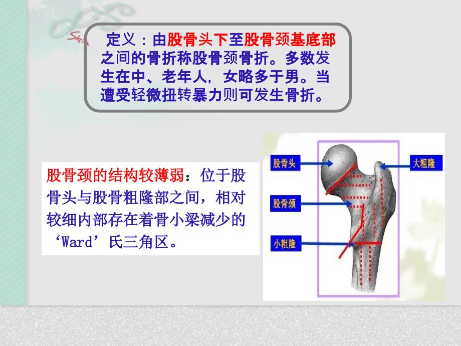 髋关节置换术后护理_第2页