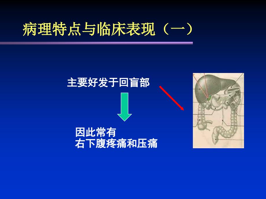 肠结核及结核性腹膜炎课件_第3页