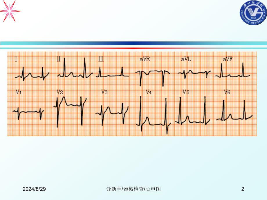 心电图ppt课件_第2页