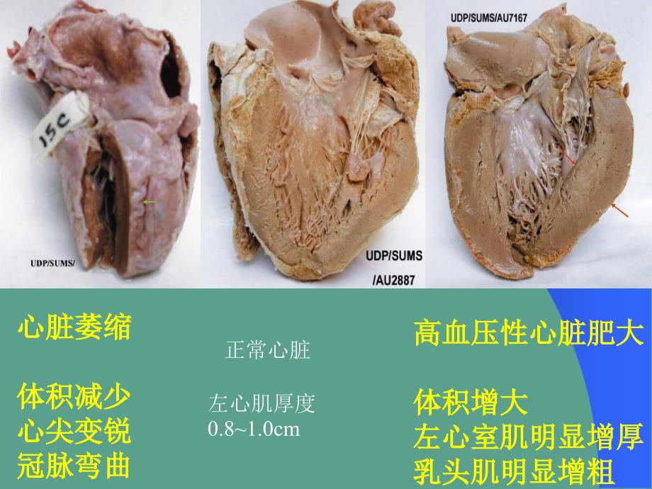 病理标本复习资料大体ppt课件_第3页