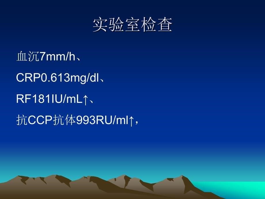 类风湿性关节炎疑难病例讨论课件_第5页