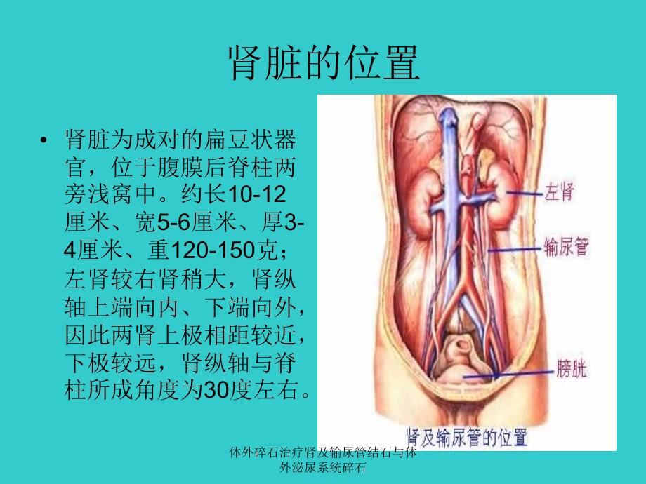 体外碎石治疗肾及输尿管结石与体外泌尿系统碎石课件_第3页