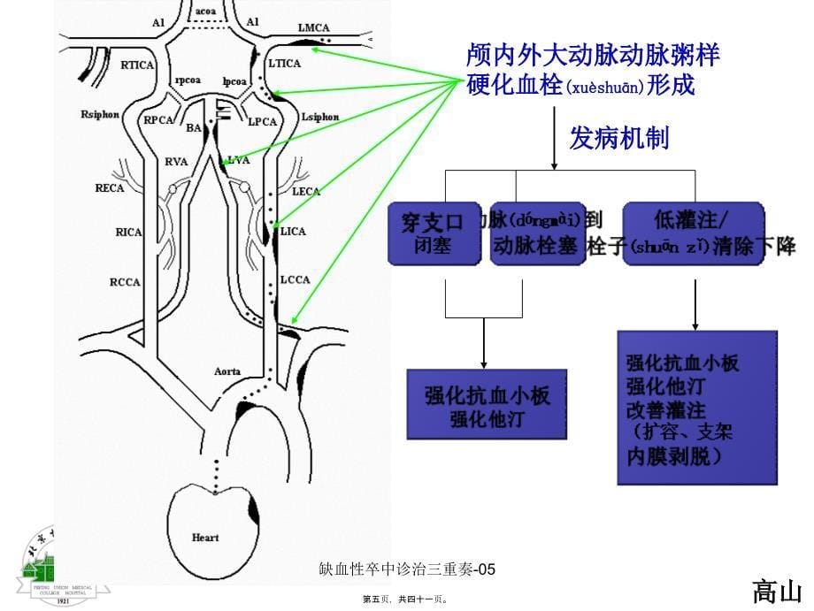 缺血性卒中诊治三重奏-05课件_第5页