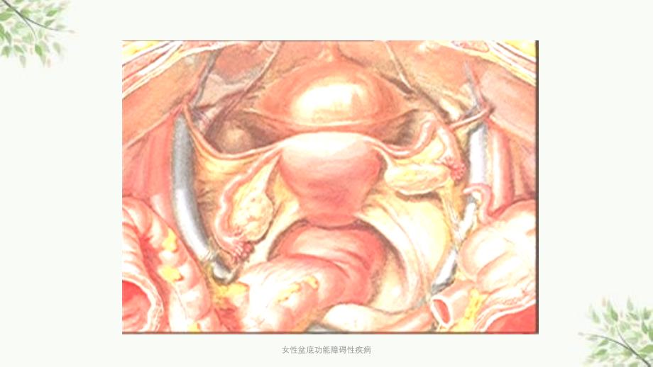 女性盆底功能障碍性疾病课件_第4页