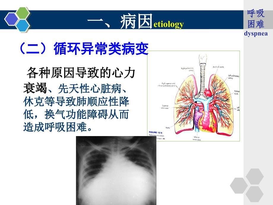 新生儿呼吸困难的护理_第5页