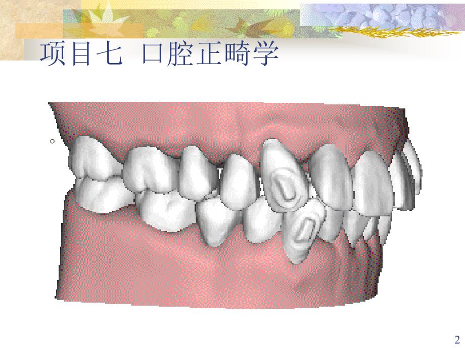 口腔正畸学概述汇总.课件_第2页