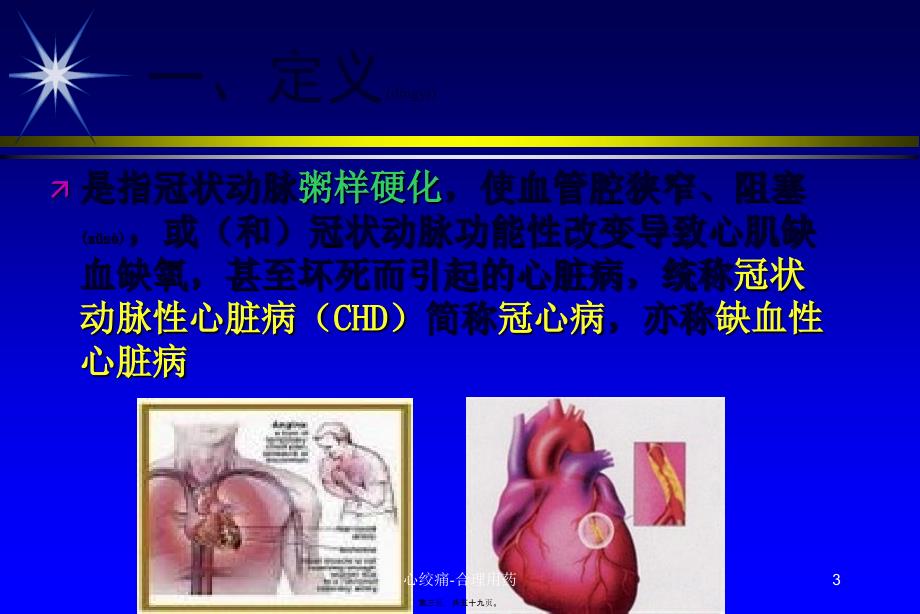 心绞痛-合理用药课件_第3页