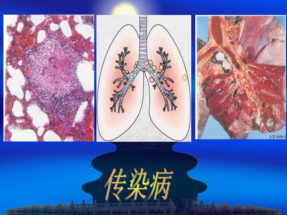 病理学传染病部分 ppt课件_第1页