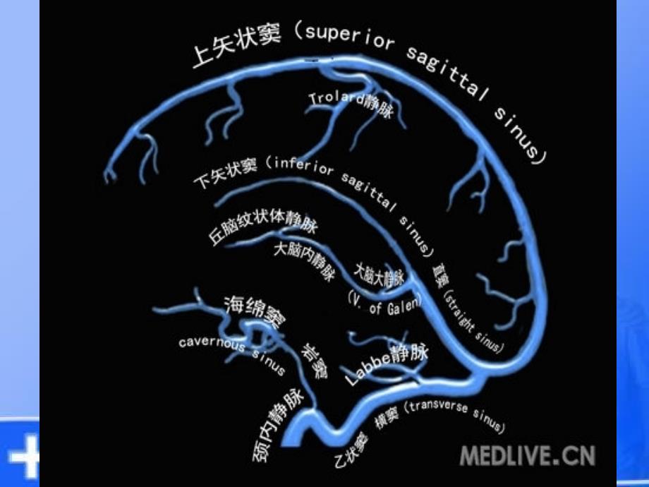 中国脑静脉系血栓形成指导规范_第4页