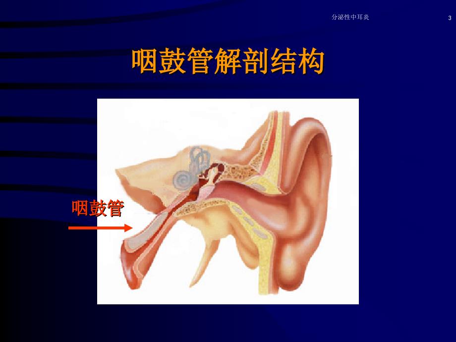 分泌性中耳炎PPT演示幻灯片_第3页