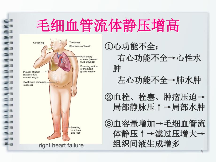 腹水水肿肾脏疾病_第4页