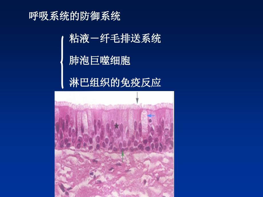 病理学-第七章-呼吸系统疾病_第4页