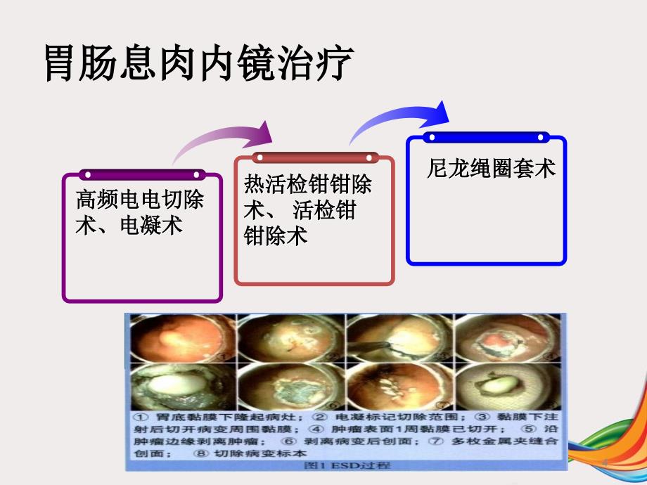 胃肠息肉摘除术ppt课件_第4页