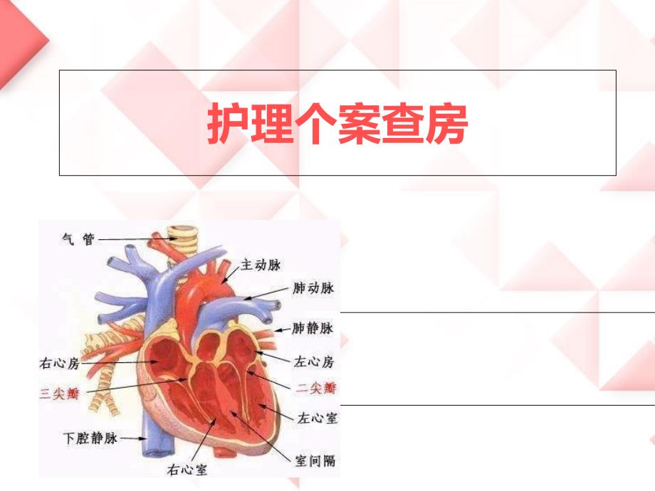 急性心肌梗死护理个案查房东九_第1页