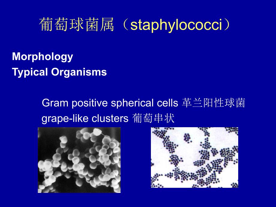 肺炎链球菌课件_第2页