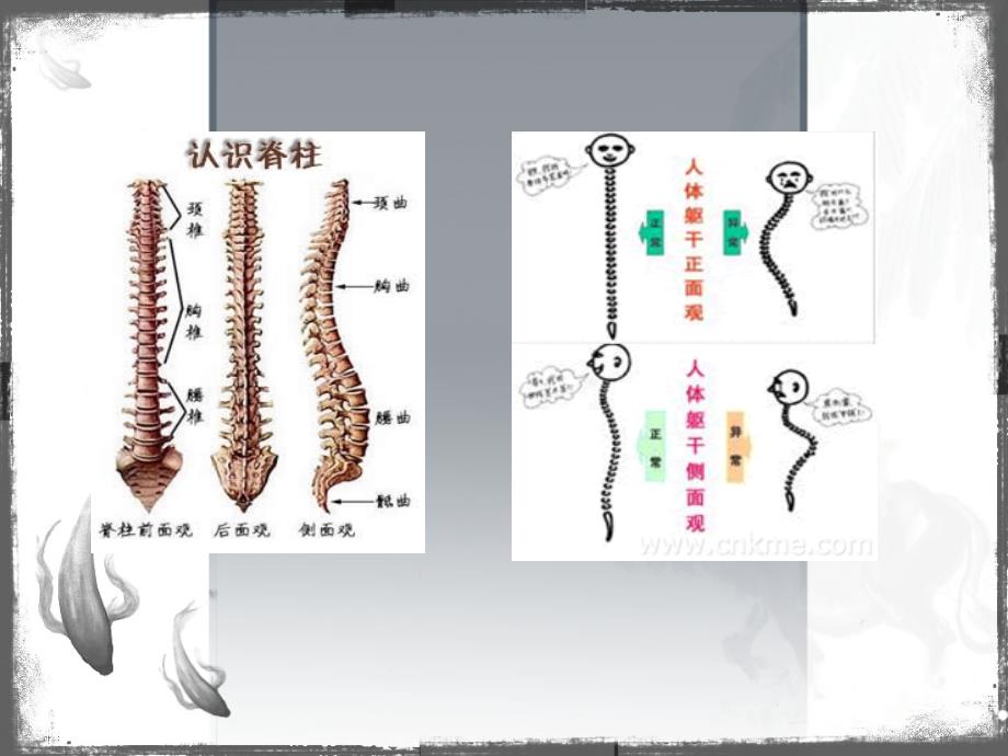 班会(脊柱侧弯概述)课件_第4页