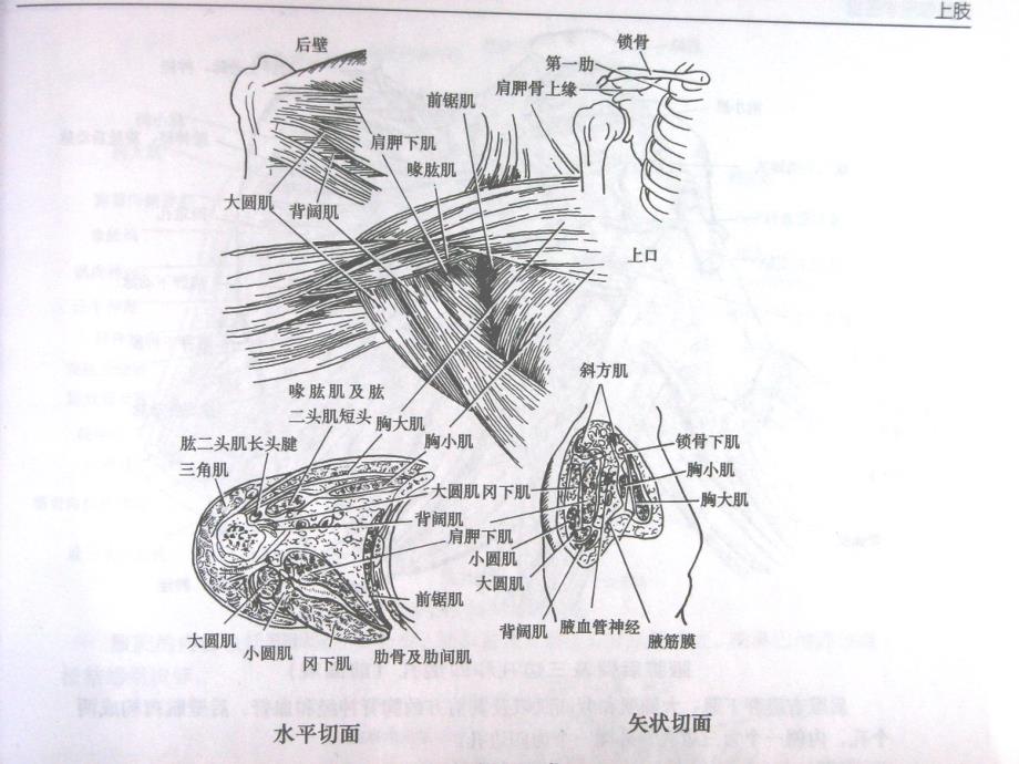 腋窝解剖及腋窝清扫_第3页