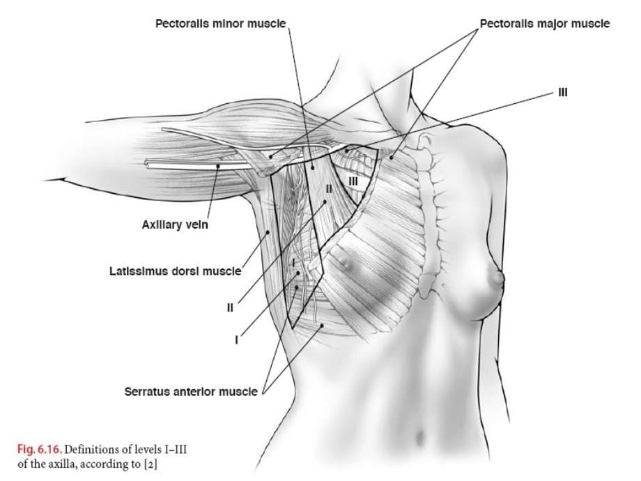 腋窝解剖及腋窝清扫_第5页