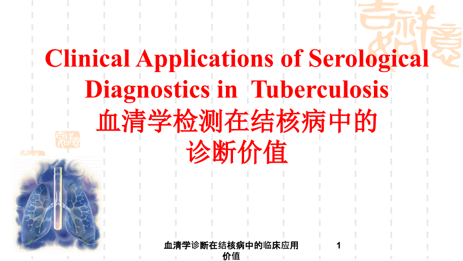 血清学诊断在结核病中的临床应用价值课件_第1页