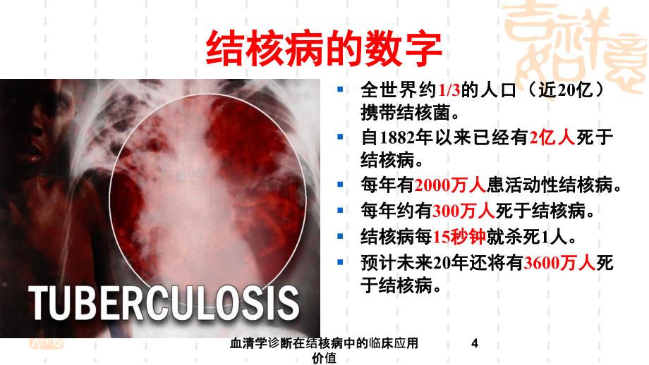 血清学诊断在结核病中的临床应用价值课件_第4页