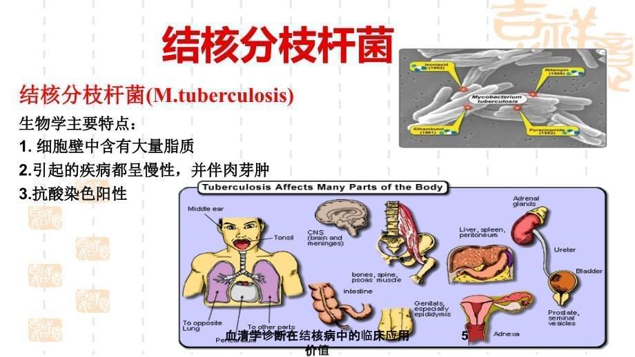 血清学诊断在结核病中的临床应用价值课件_第5页