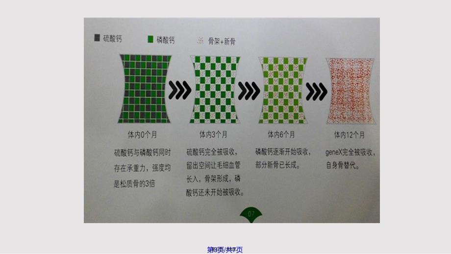 genex人工骨粉实用教案_第3页