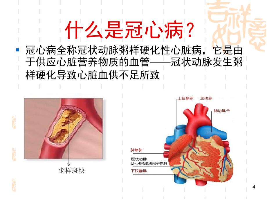 优质课件冠心病科普_第4页