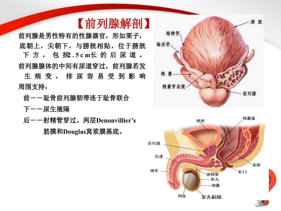 前列腺增生症._第3页