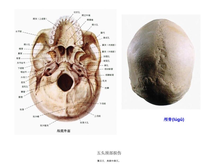 五头颈部损伤课件_第3页