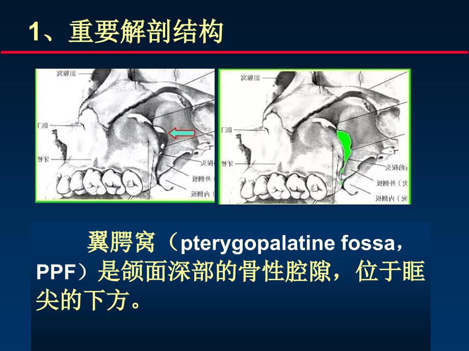 翼腭窝解剖--msct-_第3页