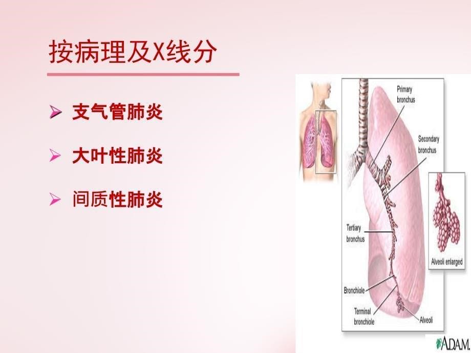 肺炎患儿的护理及健康教育_第5页