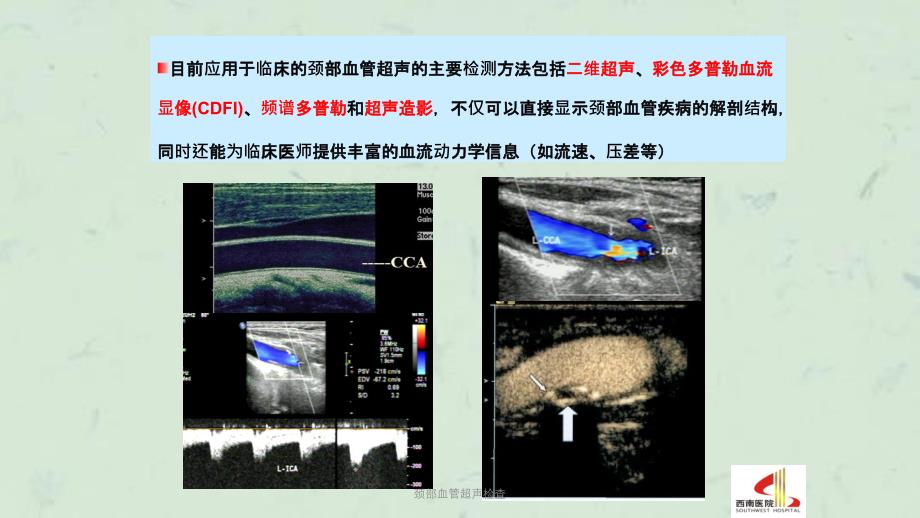颈部血管超声检查课件_第3页