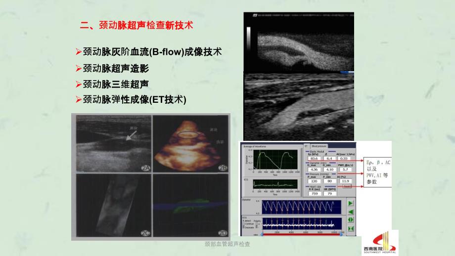 颈部血管超声检查课件_第4页