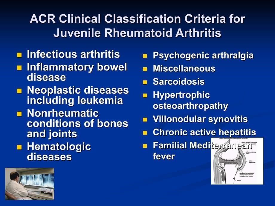 幼年特发性关节炎诊治策略_第5页