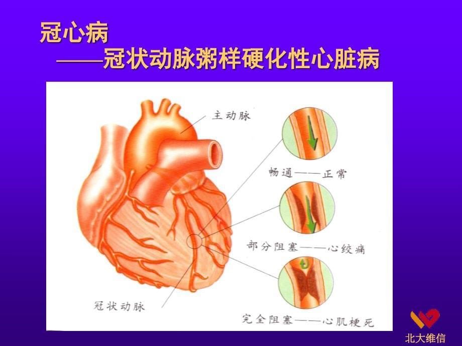 《心脑血管病讲座》PPT课件_第5页