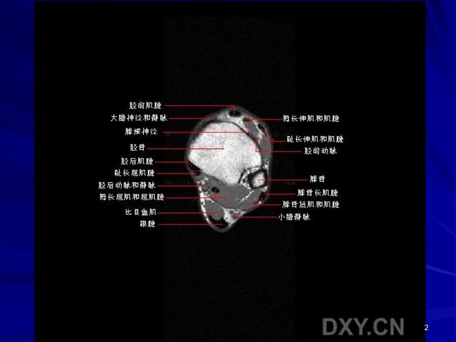 （优质课件）正常踝关节MR解剖_第2页