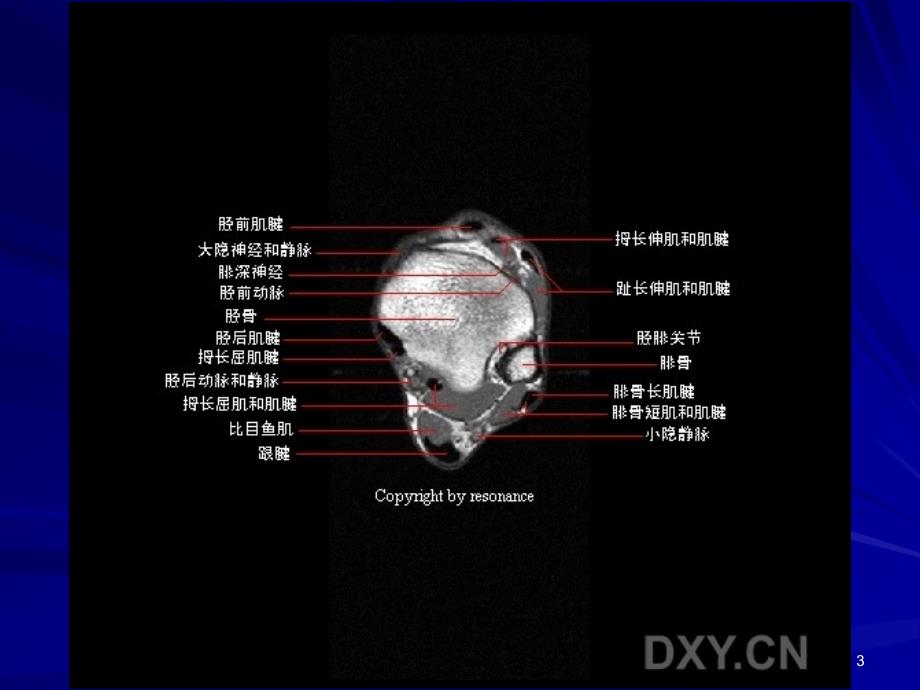 （优质课件）正常踝关节MR解剖_第3页