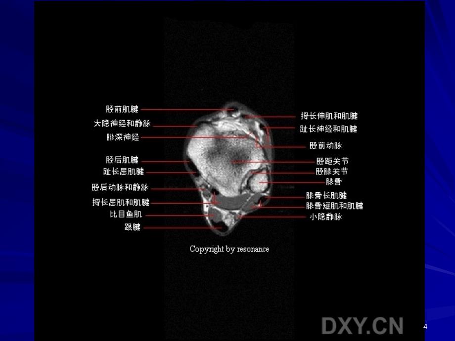 （优质课件）正常踝关节MR解剖_第4页