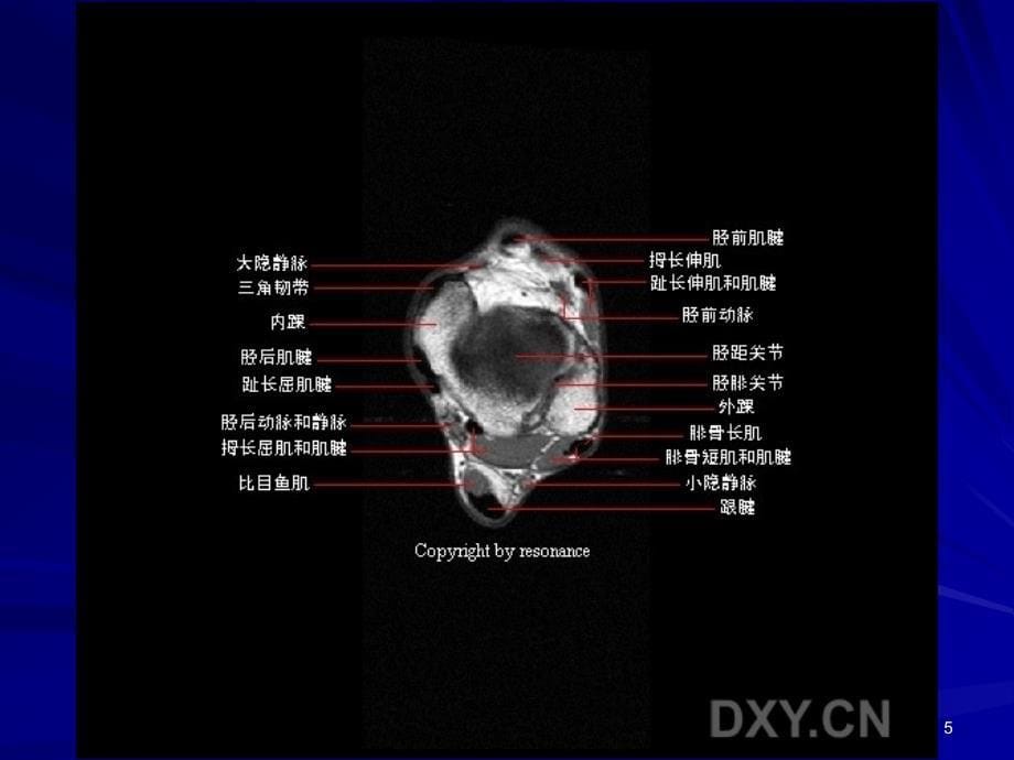 （优质课件）正常踝关节MR解剖_第5页